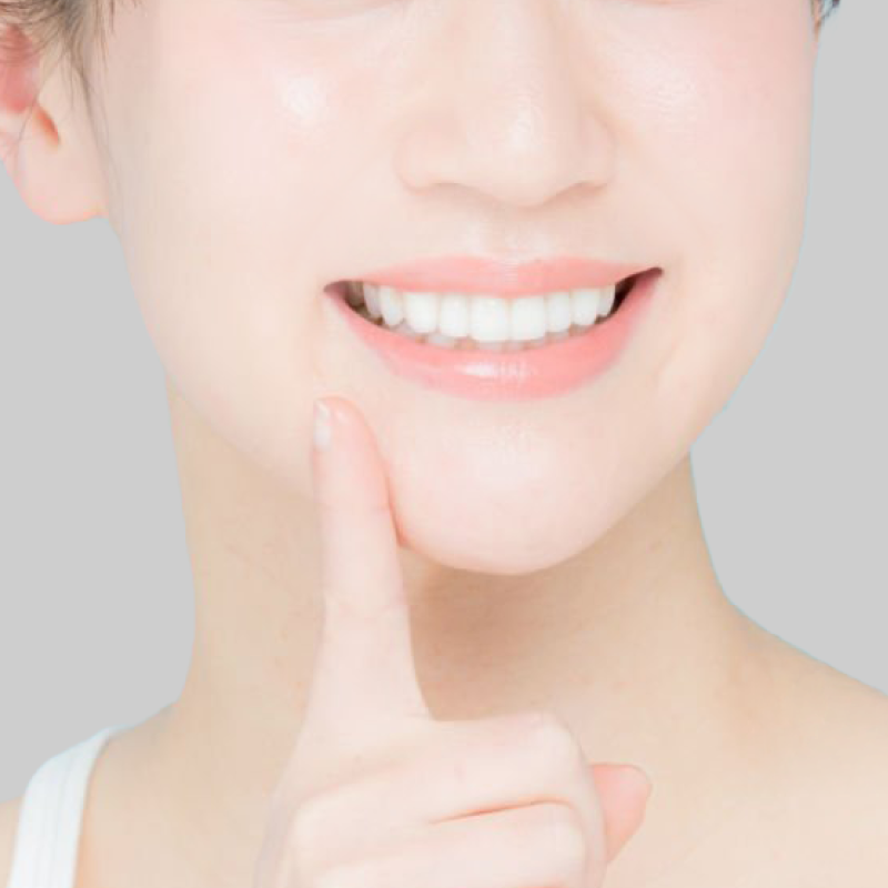 神戸・三宮の医療ホワイトニングサロン SHIROの施術写真